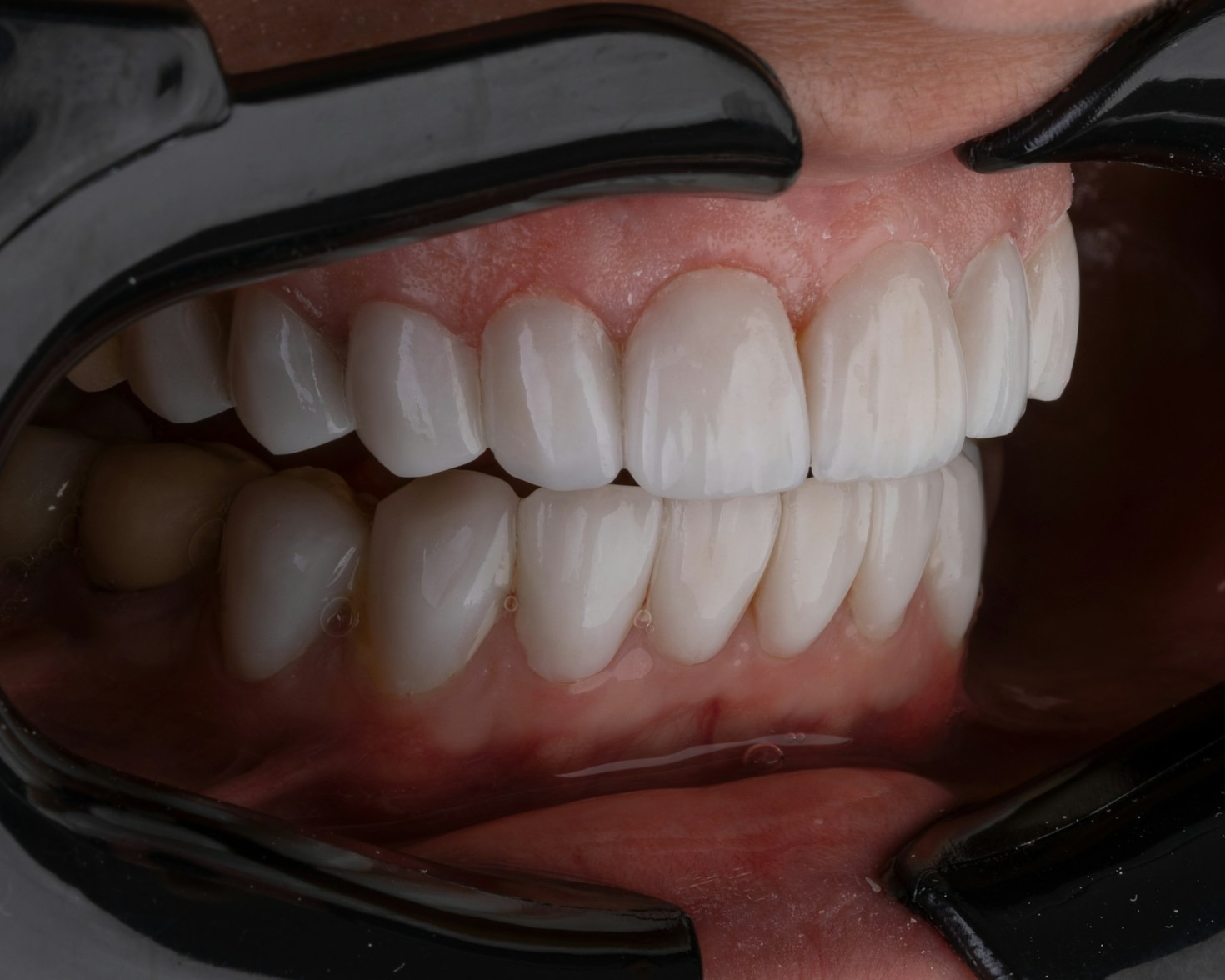 A importância da higiene para o sorriso